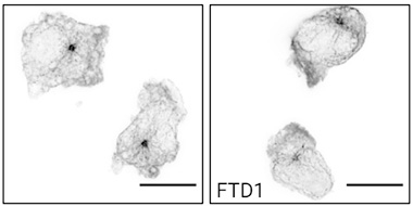 Microglia Make Tau, Spelling Their Demise in Tauopathies