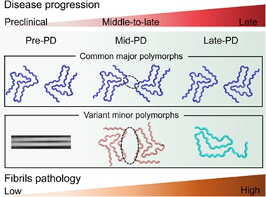 As Parkinson’s Progresses, Do Synuclein Fibrils Shape-Shift? | ALZFORUM